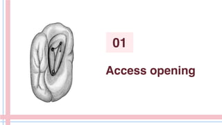 Access opening
01
 