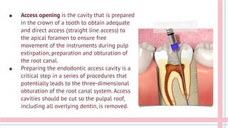 ● Access opening is the cavity that is prepared
in the crown of a tooth to obtain adequate
and direct access (straight line access) to
the apical foramen to ensure free
movement of the instruments during pulp
extirpation, preparation and obturation of
the root canal.
● Preparing the endodontic access cavity is a
critical step in a series of procedures that
potentially leads to the three-dimensional
obturation of the root canal system. Access
cavities should be cut so the pulpal roof,
including all overlying dentin, is removed.
 