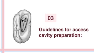 Guidelines for access
cavity preparation:
03
 