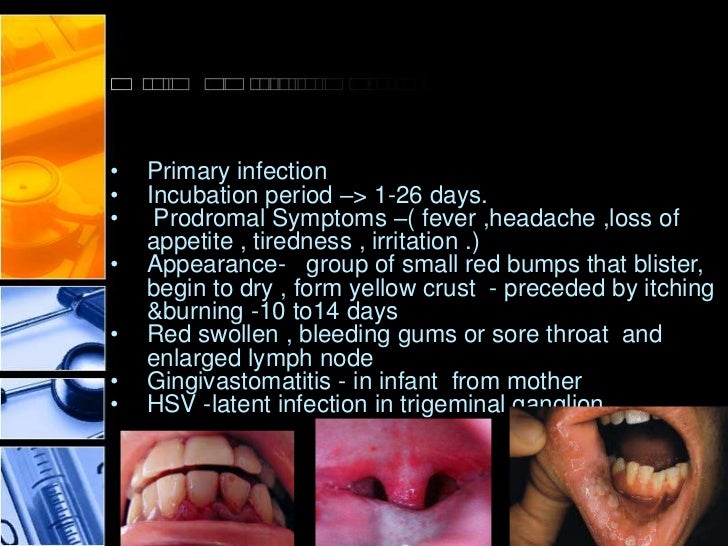 clinical presentation of oral herpes