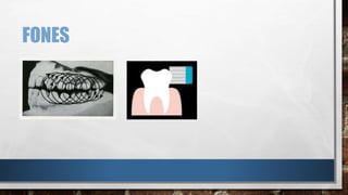 FONES 
 