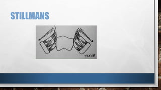 STILLMANS 
 