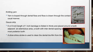 Knitting yarn 
• Yarn is looped through dental floss and floss is drawn through the contact area in the 
usual manner. 
Gauze strip 
• 6 or 8 inch length of 1 inch bandage is folded in thirds and placed around a tooth 
adjacent an edentulous area, a tooth with inter dental spacing or the distal surface of the 
most posterior tooth. 
• A shoe shine stroke is used to clean the dental bio-film from the surface 
 