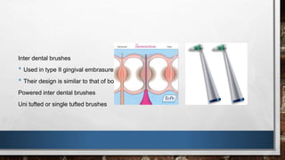 Inter dental brushes 
• Used in type II gingival embrasure. 
• Their design is similar to that of bottle brush 
Powered inter dental brushes 
Uni tufted or single tufted brushes 
 