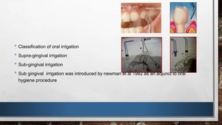 • Classification of oral irrigation 
• Supra-gingival irrigation 
• Sub-gingival irrigation 
• Sub gingival irrigation was introduced by newman et al 1982 as an adjunct to oral 
hygiene procedure 
 