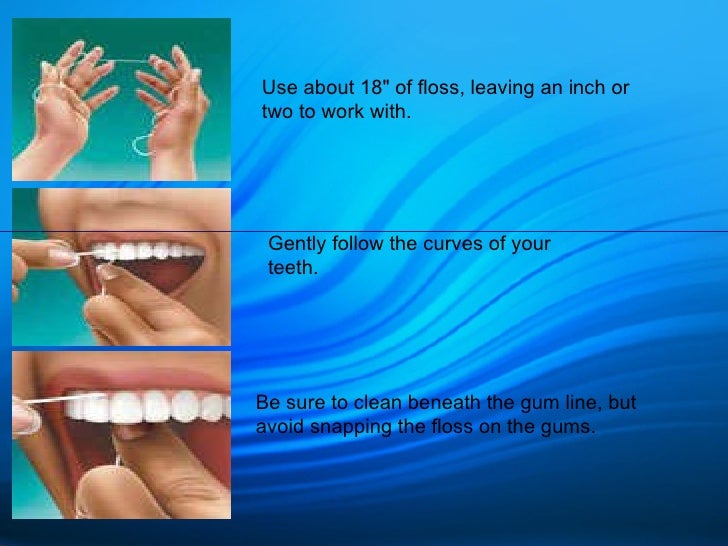 Oral Hygeine Instructions