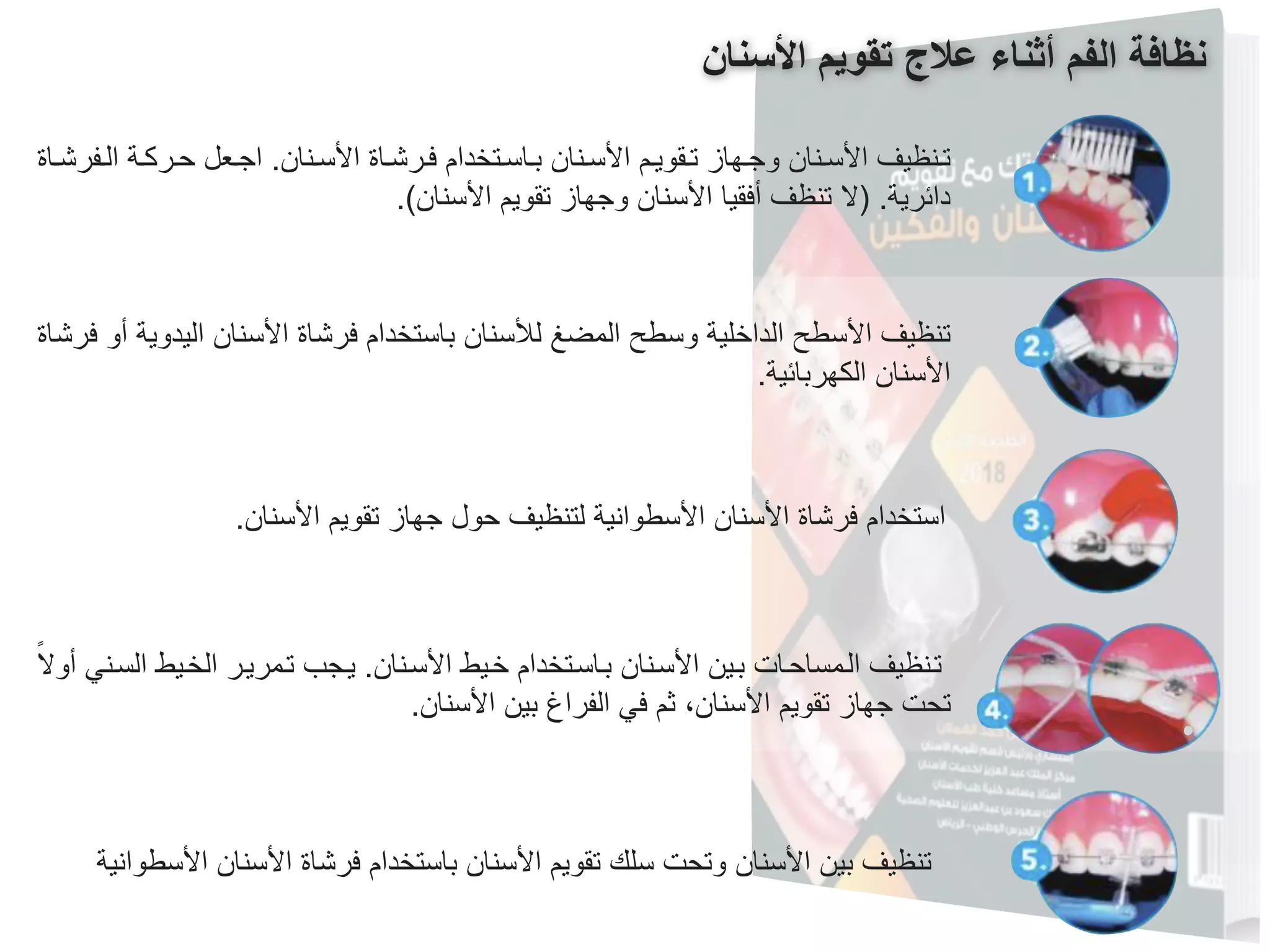 Oral Hygiene Instructions for Orthodontic Patient In Arabic PPT