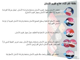 ‫اﻷﺳﻧﺎن‬ ‫ﺗﻘوﯾم‬ ‫ﻋﻼج‬ ‫أﺛﻧﺎء‬ ‫اﻟﻔم‬ ‫ﻧظﺎﻓﺔ‬
‫اﻟـﻔرﺷـﺎة‬ ‫ﺣـرﻛـﺔ‬ ‫اﺟـﻌل‬ .‫اﻷﺳـﻧﺎن‬ ‫ﻓـرﺷـﺎة‬ ‫ﺑـﺎﺳـﺗﺧدام‬ ‫اﻷﺳـﻧﺎن‬ ‫ﺗـﻘوﯾـم‬ ‫وﺟـﮭﺎز‬ ‫اﻷﺳـﻧﺎن‬ ‫ﺗـﻧظﯾف‬
.(‫اﻷﺳﻧﺎن‬ ‫ﺗﻘوﯾم‬ ‫وﺟﮭﺎز‬ ‫اﻷﺳﻧﺎن‬ ‫أﻓﻘﯾﺎ‬ ‫ﺗﻧظف‬ ‫)ﻻ‬ .‫داﺋرﯾﺔ‬
‫ـﺎة‬‫ﺷ‬‫ـر‬‫ﻓ‬ ‫أو‬ ‫اﻟﯾدوﯾﺔ‬ ‫ـﻧﺎن‬‫ﺳ‬‫اﻷ‬ ‫ـﺎة‬‫ﺷ‬‫ـر‬‫ﻓ‬ ‫ـﺗﺧدام‬‫ﺳ‬‫ـﺎ‬‫ﺑ‬ ‫ـﻧﺎن‬‫ﺳ‬‫ـﻸ‬‫ﻟ‬ ‫ـﻣﺿﻎ‬‫ﻟ‬‫ا‬ ‫ـطﺢ‬‫ﺳ‬‫و‬ ‫ـﻠﯾﺔ‬‫ﺧ‬‫ـدا‬‫ﻟ‬‫ا‬ ‫ـطﺢ‬‫ﺳ‬‫اﻷ‬ ‫ـﻧظﯾف‬‫ﺗ‬
.‫اﻟﻛﮭرﺑﺎﺋﯾﺔ‬ ‫اﻷﺳﻧﺎن‬
‫اﻷﺳطواﻧﯾﺔ‬ ‫اﻷﺳﻧﺎن‬ ‫ﻓرﺷﺎة‬ ‫ﺑﺎﺳﺗﺧدام‬ ‫اﻷﺳﻧﺎن‬ ‫ﺗﻘوﯾم‬ ‫ﺳﻠك‬ ‫وﺗﺣت‬ ‫اﻷﺳﻧﺎن‬ ‫ﺑﯾن‬ ‫ﺗﻧظﯾف‬
.‫اﻷﺳﻧﺎن‬ ‫ﺗﻘوﯾم‬ ‫ﺟﮭﺎز‬ ‫ﺣول‬ ‫ﻟﺗﻧظﯾف‬ ‫اﻷﺳطواﻧﯾﺔ‬ ‫اﻷﺳﻧﺎن‬ ‫ﻓرﺷﺎة‬ ‫اﺳﺗﺧدام‬
ً‫أوﻻ‬ ‫ـﻧﻲ‬‫ﺳ‬‫اﻟ‬ ‫ـﯾط‬‫ﺧ‬‫اﻟ‬ ‫ـر‬‫ﯾ‬‫ـﻣر‬‫ﺗ‬ ‫ـﺟب‬‫ﯾ‬ .‫ـﻧﺎن‬‫ﺳ‬‫اﻷ‬ ‫ـﯾط‬‫ﺧ‬ ‫ـﺗﺧدام‬‫ﺳ‬‫ـﺎ‬‫ﺑ‬ ‫ـﻧﺎن‬‫ﺳ‬‫اﻷ‬ ‫ـﯾن‬‫ﺑ‬ ‫ـﺎت‬‫ﺣ‬‫ـﻣﺳﺎ‬‫ﻟ‬‫ا‬ ‫ـﻧظﯾف‬‫ﺗ‬
.‫اﻷﺳﻧﺎن‬ ‫ﺑﯾن‬ ‫اﻟﻔراغ‬ ‫ﻓﻲ‬ ‫ﺛم‬ ،‫اﻷﺳﻧﺎن‬ ‫ﺗﻘوﯾم‬ ‫ﺟﮭﺎز‬ ‫ﺗﺣت‬
 
