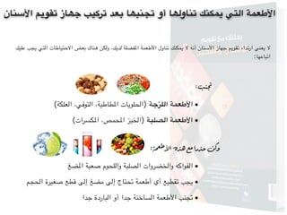 ‫األسنان‬ ‫تقویم‬ ‫جھاز‬ ‫تركیب‬ ‫بعد‬ ‫تجنبھا‬ ‫أو‬ ‫تناولھا‬ ‫یمكنك‬ ‫التي‬ ‫األطعمة‬
‫عليك‬ ‫يجب‬ ‫التي‬ ‫االحتياطات‬ ‫بعض‬ ‫هناك‬ ‫ولكن‬ ،‫لديك‬ ‫املفضلة‬ ‫األطعمة‬ ‫تناول‬ ‫يمكنك‬ ‫ال‬ ‫أنه‬ ‫األسنان‬ ‫جهاز‬ ‫تقويم‬ ‫ارتداء‬ ‫يعني‬ ‫ال‬
:‫اتباعها‬
:‫نب‬‫تج‬
•(‫العلكة‬ ،‫التوفي‬ ،‫املطاطية‬ ‫)الحلويات‬ ‫اللزجة‬ ‫األطعمة‬
•(‫املكسرات‬ ،‫املحمص‬ ‫)الخبز‬ ‫الصلبة‬ ‫األطعمة‬
:‫ة‬‫م‬‫طع‬‫األ‬‫ه‬‫هذ‬‫مع‬‫ا‬‫ر‬‫حذ‬‫كن‬‫و‬
•‫املضغ‬ ‫صعبة‬ ‫واللحوم‬ ‫الصلبة‬ ‫والخضروات‬ ‫الفواكه‬
•‫الحجم‬ ‫صغيرة‬ ‫قطع‬ ‫إلى‬ ‫مضغ‬ ‫إلى‬ ‫تحتاج‬ ‫أطعمة‬ ‫أي‬ ‫تقطيع‬ ‫يجب‬
•‫جدا‬ ‫الباردة‬ ‫أو‬ ‫جدا‬ ‫الساخنة‬ ‫األطعمة‬ ‫تجنب‬
 