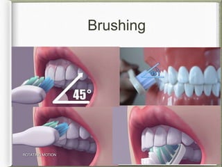 Brushing
 