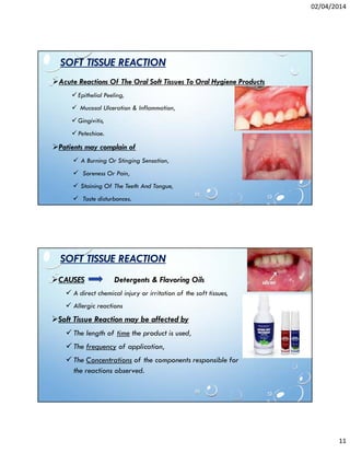 02/04/2014
11
SOFT TISSUE REACTION
Acute Reactions Of The Oral Soft Tissues To Oral Hygiene Products
Epithelial Peeling,
Mucosal Ulceration & Inflammation,
Gingivitis,
Petechiae.
Patients may complain of
A Burning Or Stinging Sensation,
Soreness Or Pain,
Staining Of The Teeth And Tongue,
Taste disturbances.
SOFT TISSUE REACTION
CAUSES Detergents & Flavoring Oils
A direct chemical injury or irritation of the soft tissues,
Allergic reactions
Soft Tissue Reaction may be affected by
The length of time the product is used,
The frequency of application,
The Concentrations of the components responsible for
the reactions observed.
 