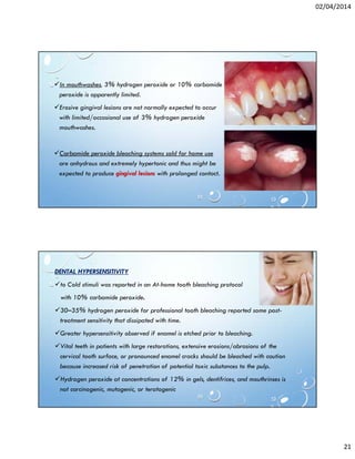 02/04/2014
21
In mouthwashes, 3% hydrogen peroxide or 10% carbamide
peroxide is apparently limited.
Erosive gingival lesions are not normally expected to occur
with limited/occasional use of 3% hydrogen peroxide
mouthwashes.
Carbamide peroxide bleaching systems sold for home use
are anhydrous and extremely hypertonic and thus might be
expected to produce gingival lesions with prolonged contact.
DENTAL HYPERSENSITIVITY
to Cold stimuli was reported in an At-home tooth bleaching protocol
with 10% carbamide peroxide.
30–35% hydrogen peroxide for professional tooth bleaching reported some post-
treatment sensitivity that dissipated with time.
Greater hypersensitivity observed if enamel is etched prior to bleaching.
Vital teeth in patients with large restorations, extensive erosions/abrasions of the
cervical tooth surface, or pronounced enamel cracks should be bleached with caution
because increased risk of penetration of potential toxic substances to the pulp.
Hydrogen peroxide at concentrations of 12% in gels, dentifrices, and mouthrinses is
not carcinogenic, mutagenic, or teratogenic
 