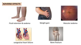 ADVERSE EFFECTS
congestive heart failure Bone fracture
Macular oedema
Fluid retention & oedema Weight gain
 