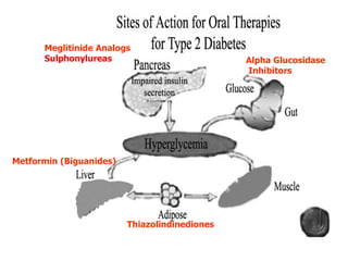 Meglitinide Analogs
Sulphonylureas
Thiazolindinediones
Metformin (Biguanides)
Alpha Glucosidase
Inhibitors
 