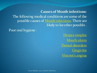 Causes of Mouth infections:
The following medical conditions are some of the
possible causes of Mouth infections. There are
likely to be other possible .
Poor oral hygiene :
Herpes simplex
Mouth ulcers
Dental disorders
Gingivitis
Vincent's angina
Amna Medani, 2015, Tutorial, Dentistry
 