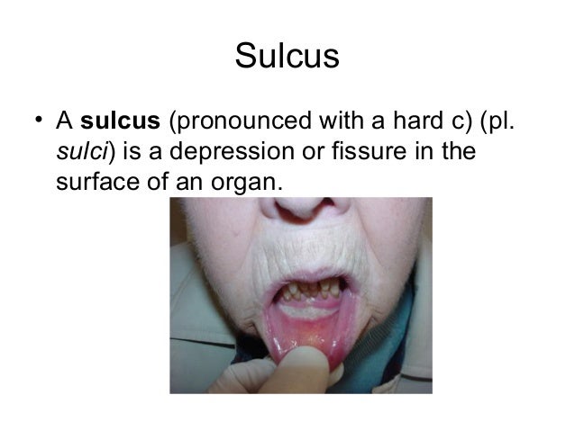 Oral landmarks