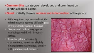 tobacco pouch keratosis treatment Oral lesions associated with the use of tobacco