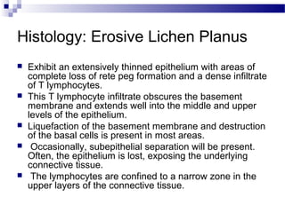 Oral lichen planus | PPT