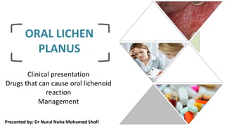 ORAL LICHEN
PLANUS
Clinical presentation
Drugs that can cause oral lichenoid
reaction
Management
Presented by: Dr Nurul Nuha Mohamad Shofi
 
