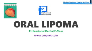 ORAL LIPOMA
Professional Dental E-Class
www.ompnet.com
 