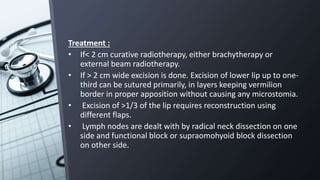 Treatment :
• If< 2 cm curative radiotherapy, either brachytherapy or
external beam radiotherapy.
• If > 2 cm wide excision is done. Excision of lower lip up to one-
third can be sutured primarily, in layers keeping vermilion
border in proper apposition without causing any microstomia.
• Excision of >1/3 of the lip requires reconstruction using
different flaps.
• Lymph nodes are dealt with by radical neck dissection on one
side and functional block or supraomohyoid block dissection
on other side.
 
