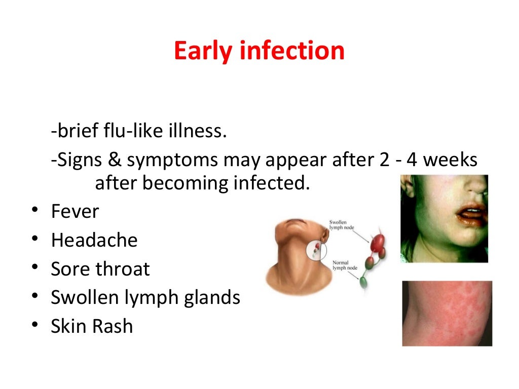 Oral Manifestation Of AIDS oral-manifestation-of-aids