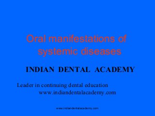 Oral manifestations of
systemic diseases
INDIAN DENTAL ACADEMY
Leader in continuing dental education
www.indiandentalacademy.com
www.indiandentalacademy.com

 
