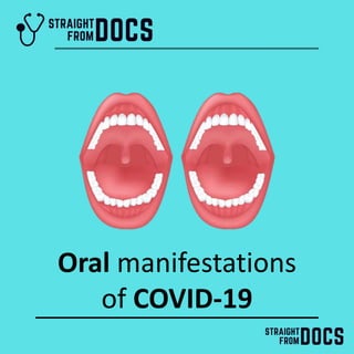 Oral manifestations
of COVID-19
 