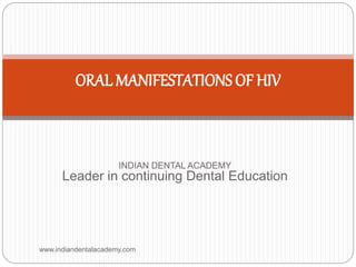 ORAL MANIFESTATIONS OF HIV
INDIAN DENTAL ACADEMY
Leader in continuing Dental Education
www.indiandentalacademy.com
 