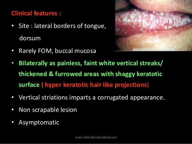 Oral manifestations of hiv aids/ dental implant courses