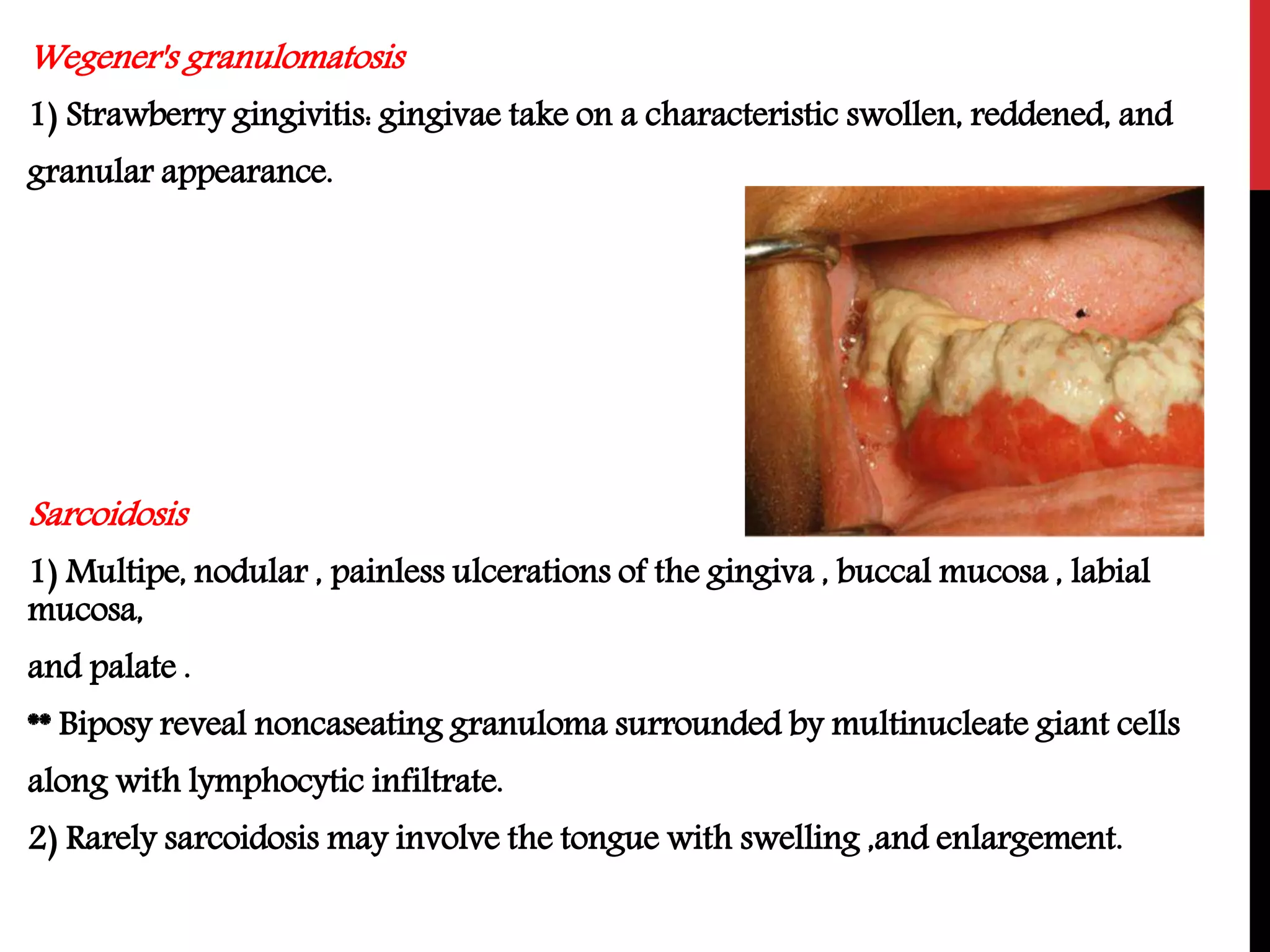 Oral manifestations of systemic disease | PPTX