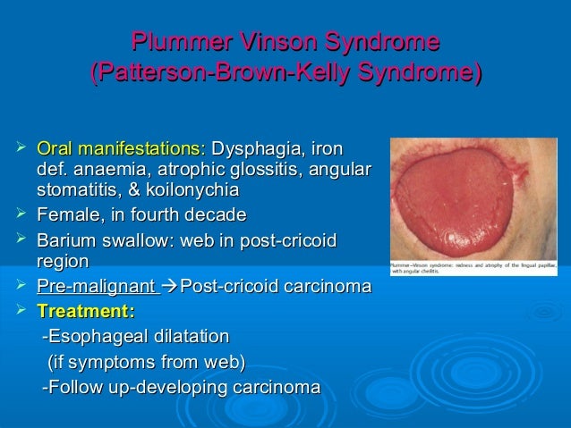 Plummer vinson syndrome pathology report