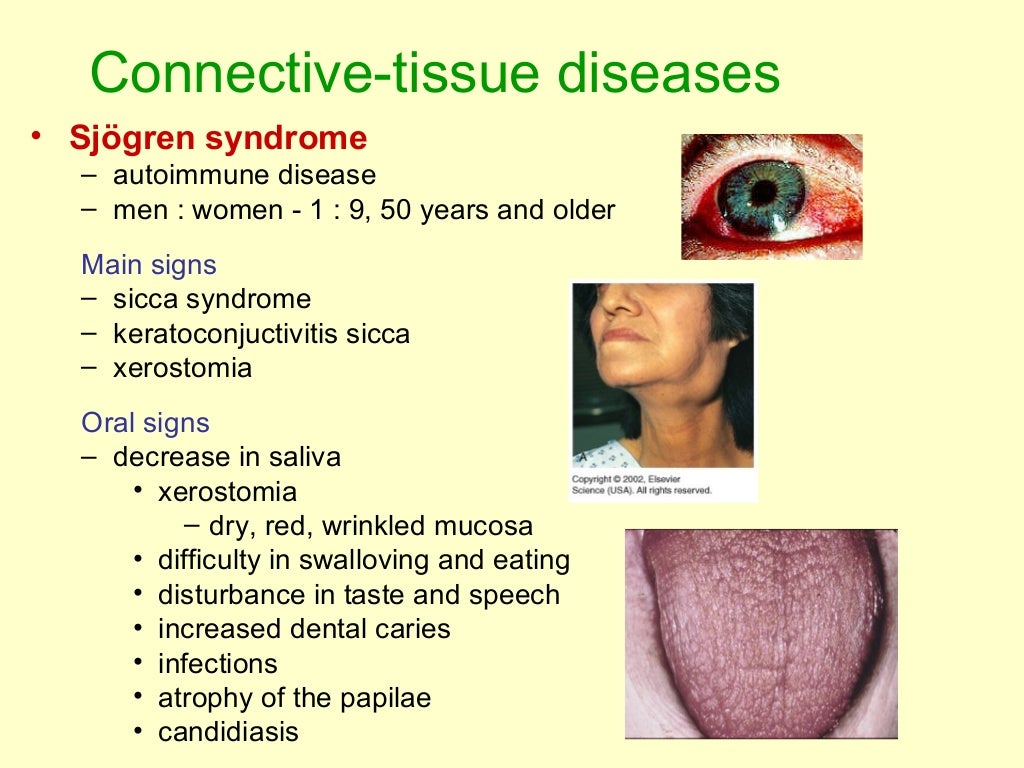 Oral manifestations of systemic diseases