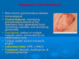 Oral Manifestations of systemic diseases.pdf