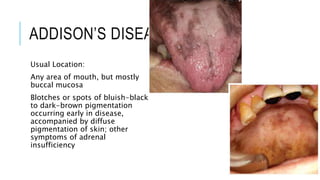ORAL MANIFESTATIONS OF SYSTEMIC MEDICAL DISORDER.pptx