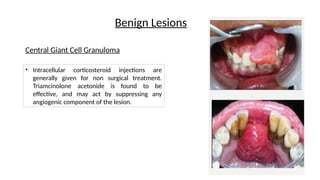 Corticosteroids in Dentistry Presentation | PPTX