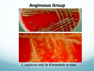 Anginosus  Group
S. anginosus may be B-hemolytic or none
 