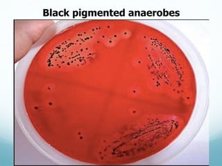 Black  pigmented  anaerobes
 