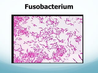 Fusobacterium
 