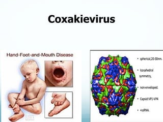 Coxakievirus
 