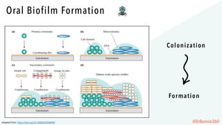 Oral Biofilm Formation
Colonization
Formation
Adapted	from:	https://doi.org/10.3390/jof3030040 @DrBonnie360
 