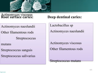 121
Root surface caries: Deep dentinal caries:
Actinomyces viscosus
Actinomyces naeslundii
Other filamentous rods
Streptococcus
mutans
Streptococcus sanguis
Streptococcus salivarius
Lactobacillus sp
Actinomyces naeslundii
Actinomyces viscosus
Other filamentous rods
Streptococcus mutans
 