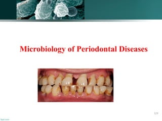 Microbiology of Periodontal Diseases
129
 