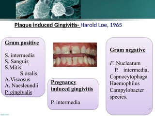 Plaque induced Gingivitis- Harold Loe, 1965
Gram positive
S. intermedia
S. Sanguis
S.Mitis
S.oralis
A.Viscosus
A. Naesleundii
P. gingivalis
Gram negative
F. Nucleatum
P. intermedia,
Capnocytophaga
Haemophilus
Campylobacter
species.
Pregnancy
induced gingivitis
P. intermedia
130
 