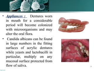 • Appliances : Dentures worn
in mouth for a considerable
period will become colonized
with microorganisms and may
alter the oral flora.
• Candida albicans can be found
in large numbers in the fitting
surfaces of acrylic dentures
while yeasts and lactobacilli in
particular, multiply on any
mucosal surface protected from
flow of saliva. 28
 