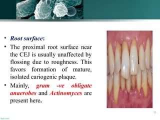 • Root surface:
• The proximal root surface near
the CEJ is usually unaffected by
flossing due to roughness. This
favors formation of mature,
isolated cariogenic plaque.
• Mainly, gram -ve obligate
anaerobes and Actinomyces are
present here.
33
 
