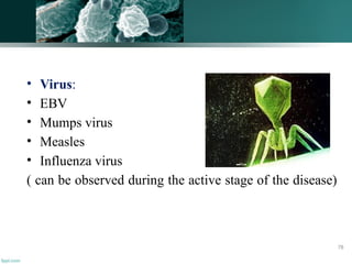 • Virus:
• EBV
• Mumps virus
• Measles
• Influenza virus
( can be observed during the active stage of the disease)
78
 