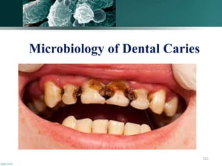 Microbiology of Dental Caries
111
 