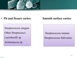 • Pit and fissure caries: Smooth surface caries:
120
Streptococcus sanguis
Other Streptococci
Lactobacilli sp
Actinomyces sp
Streptococcus mutans
Streptococcus Salivarius
 