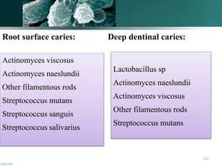 Root surface caries: Deep dentinal caries:
121
Actinomyces viscosus
Actinomyces naeslundii
Other filamentous rods
Streptococcus mutans
Streptococcus sanguis
Streptococcus salivarius
Lactobacillus sp
Actinomyces naeslundii
Actinomyces viscosus
Other filamentous rods
Streptococcus mutans
 